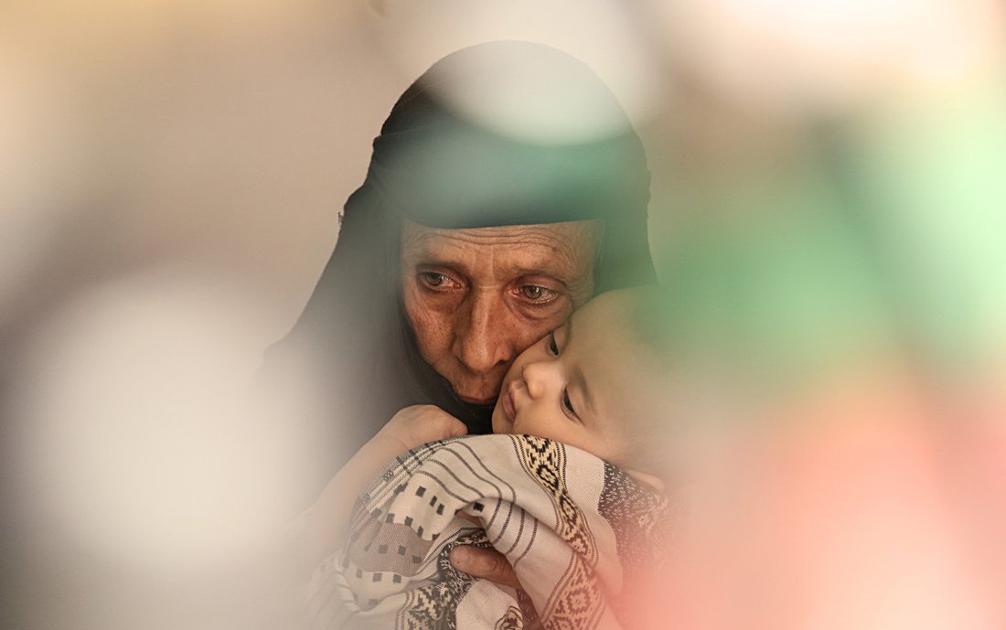 Khulood_with_her_grandmother__Cholera_outbreak__Yemen.jpg